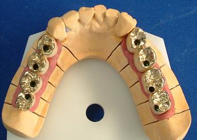 株式会社 クラフトデンタルの画像